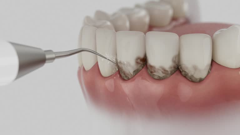 Reliable Teeth Cleaning And Checkup contractor in Yalobusha County County, MS by Dentist Open Now